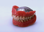 総入れ歯の画像